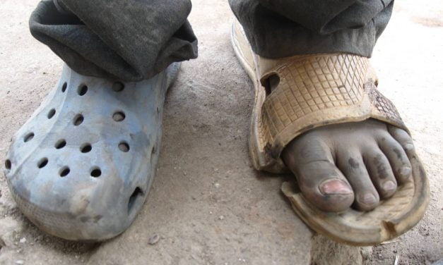 he is better than those who walk bare feet” 😂